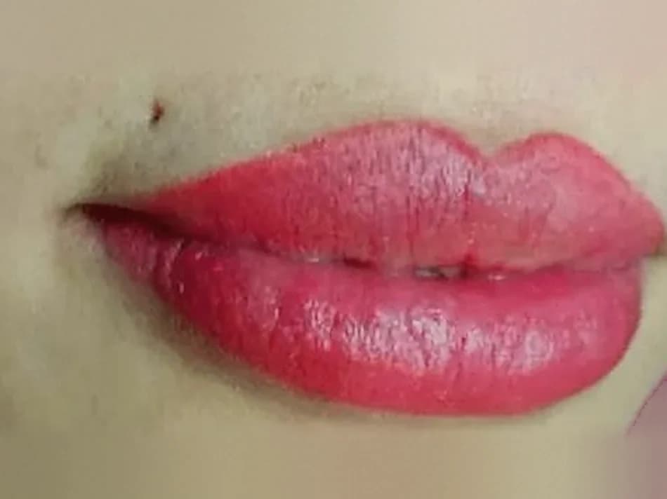 Pigmentierte Lippen in kräftigem Rot, Nahaufnahme nach der Behandlung