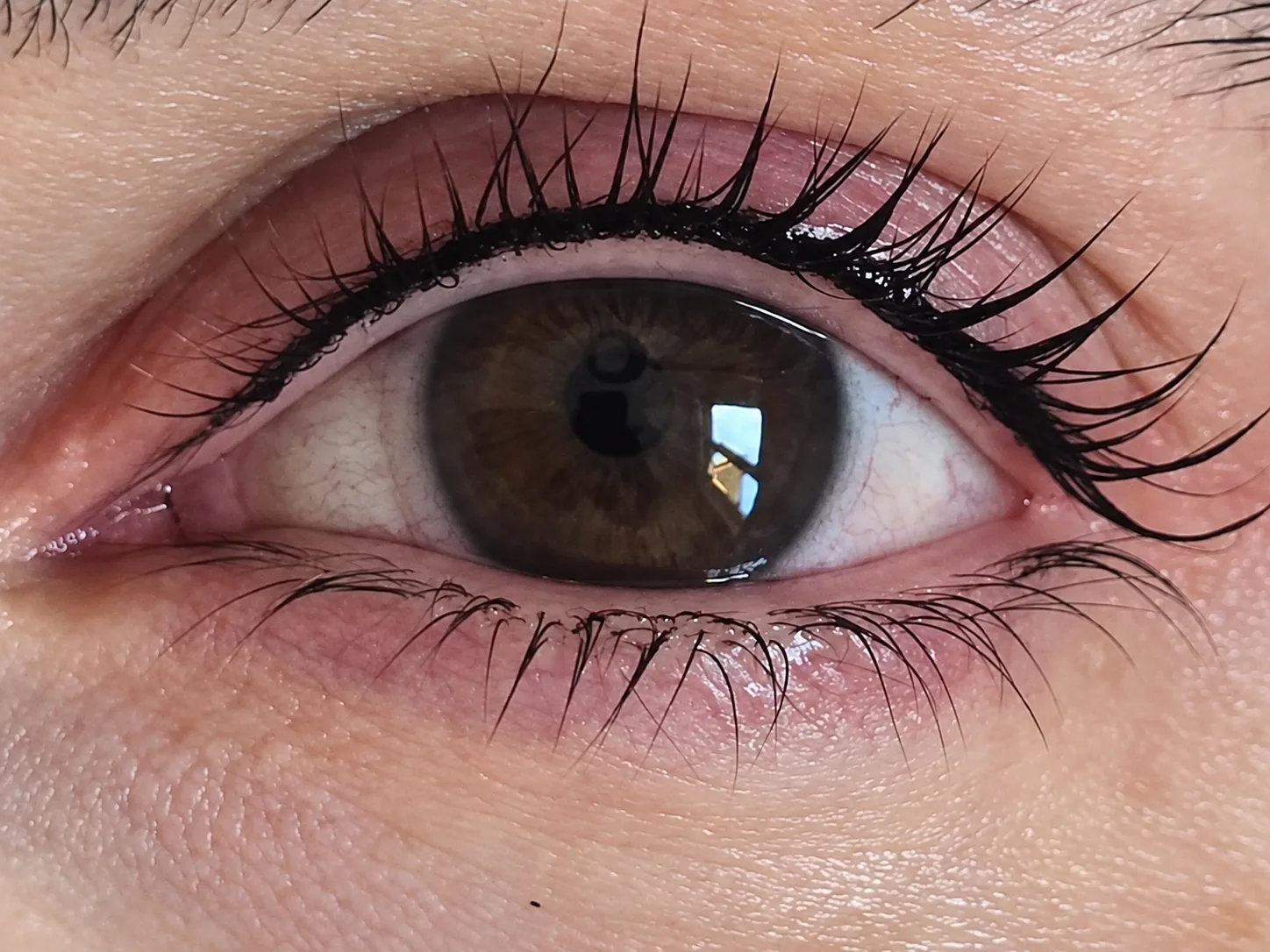 Feine dunkle Pigmentierung entlang des oberen Wimpernkranzes.