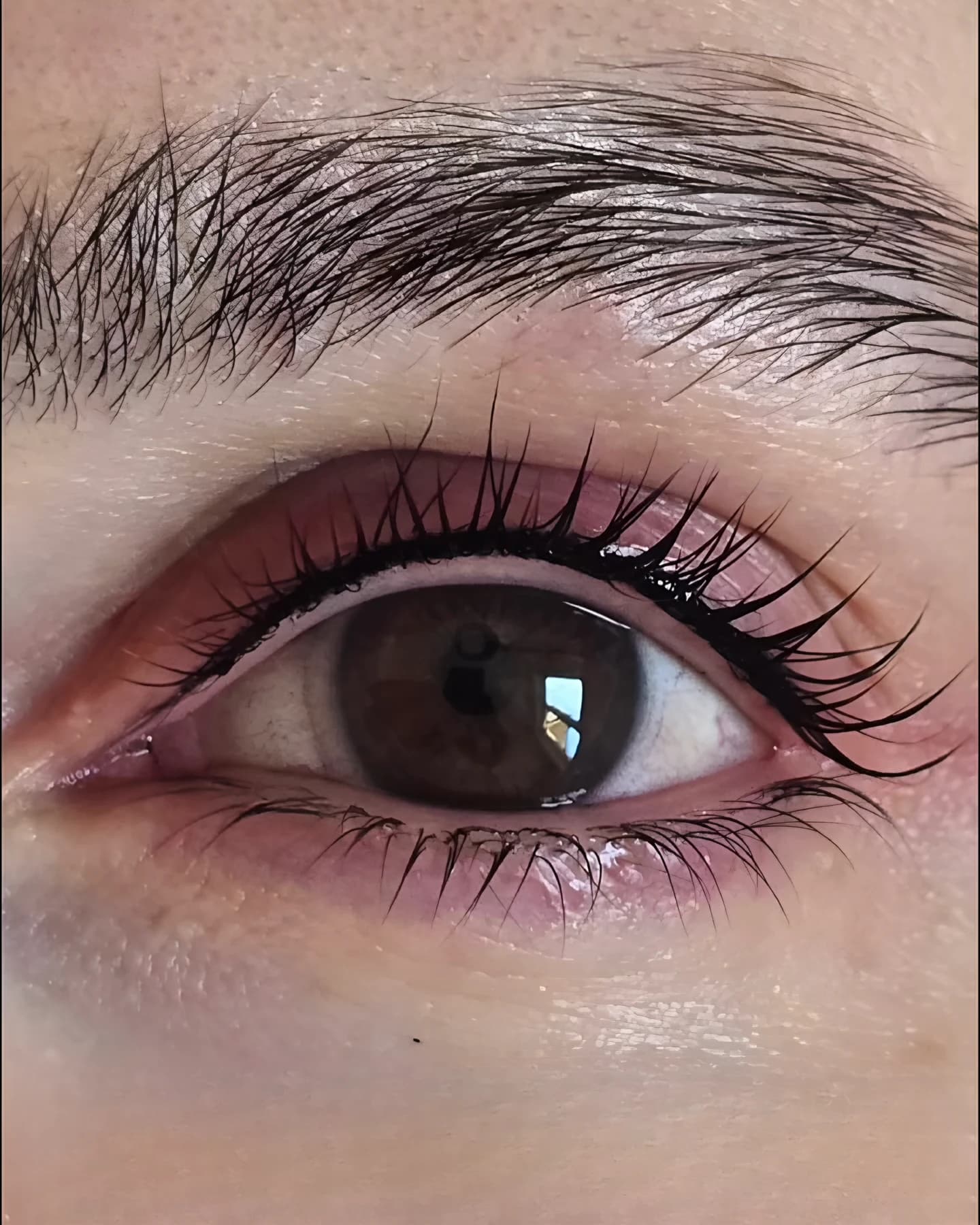 Detail einer Wimpernkranzverdichtung aus unserer Arbeit